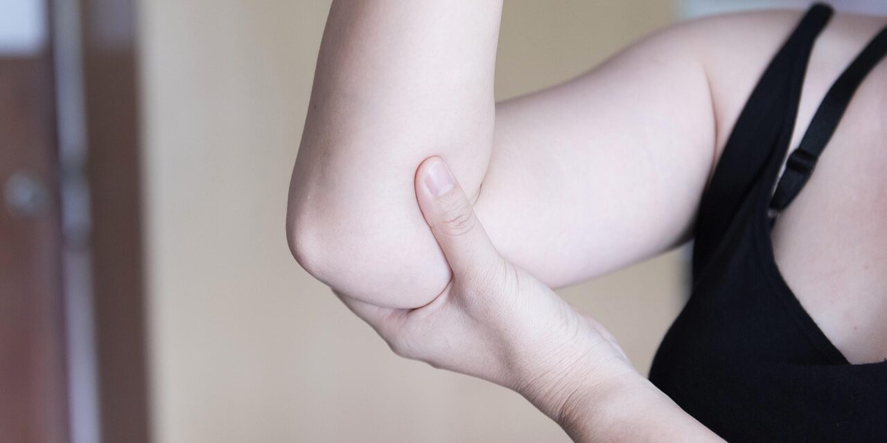 ES CLAVE TRATAR ADECUAMENTE SÍNTOMAS DE LUPUS