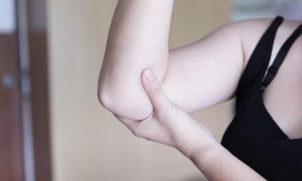 ES CLAVE TRATAR ADECUAMENTE SÍNTOMAS DE LUPUS