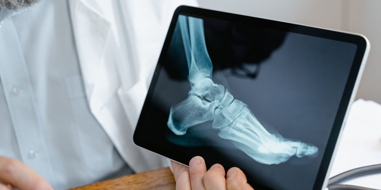 HÁBITOS SALUDABLES Y DETECCIÓN OPORTUNA PARA PREVENIR OSTEOPOROSIS