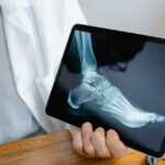 HÁBITOS SALUDABLES Y DETECCIÓN OPORTUNA PARA PREVENIR OSTEOPOROSIS