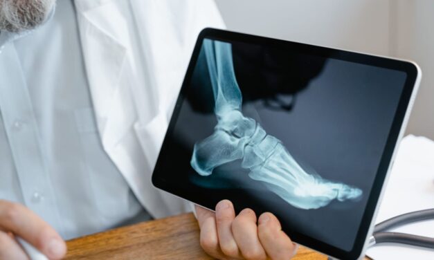HÁBITOS SALUDABLES Y DETECCIÓN OPORTUNA PARA PREVENIR OSTEOPOROSIS
